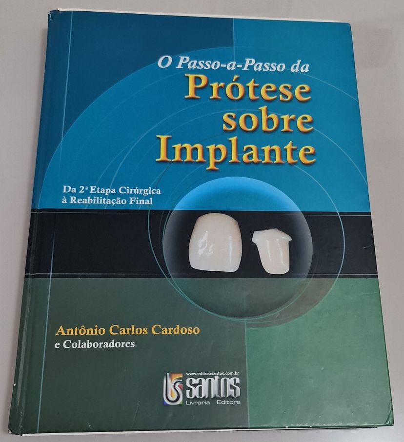 Livro de Odontologia O Passo a passo da Prótese sobre Implante Livro