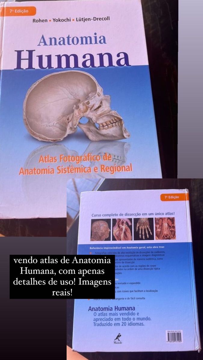 Atlas de Anatomia Humana Yokoshi, com Imagens Reais | Livro Usado ...