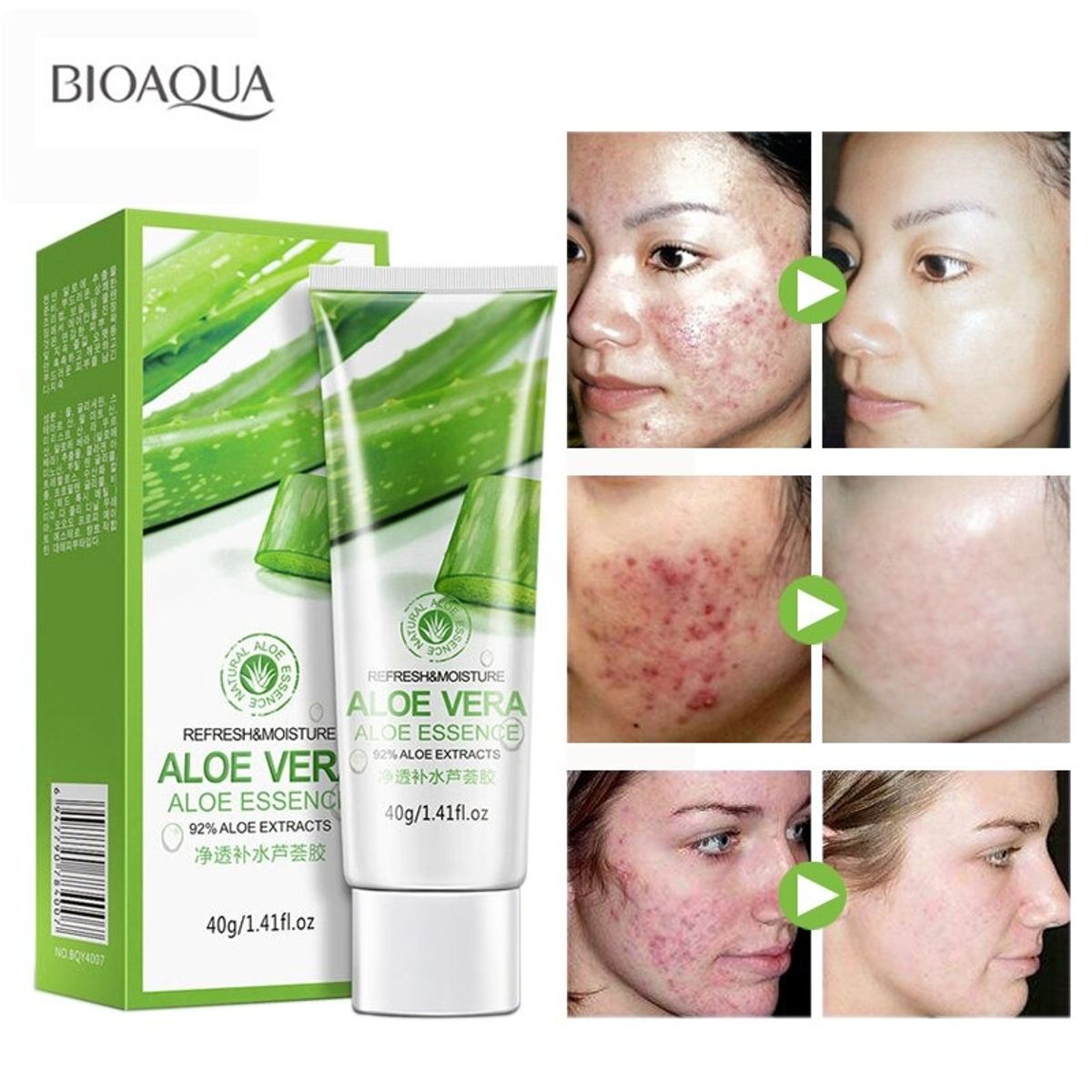 creme-facial-gel-tratamento-antiacne-espinha-cravo-aloe-vera