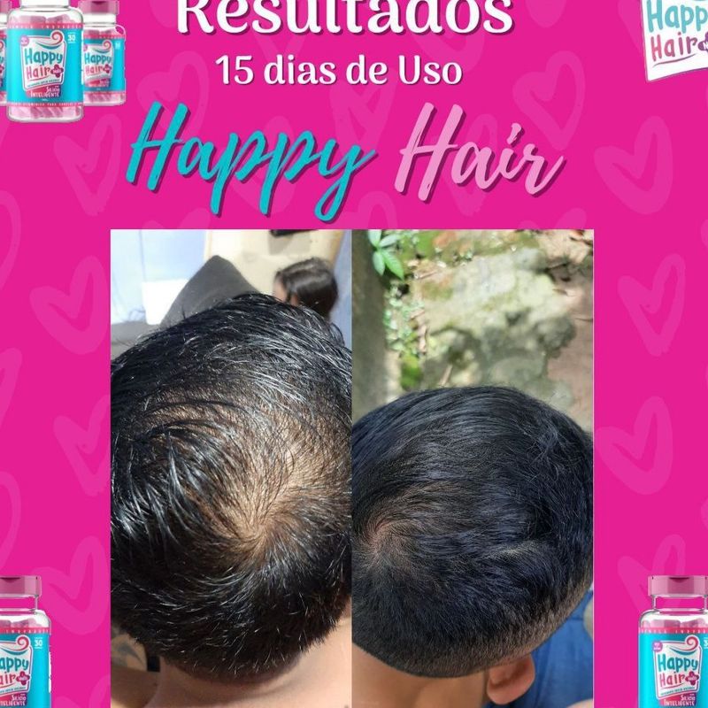 Happy Hair a Vitamina Capilar Mais Queridinha do Brasil | Cosmético Feminino Happy Hair Nunca Usado 73305801 | enjoei