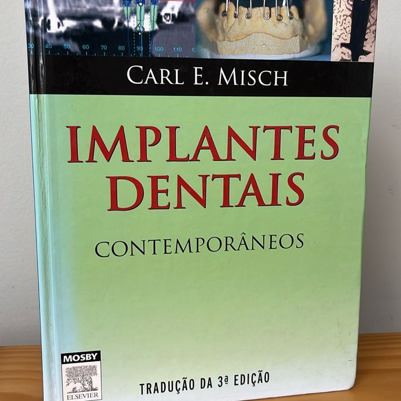 Implantes Dentais Contemporâneos | Elsevier Usado 96244381 | enjoei
