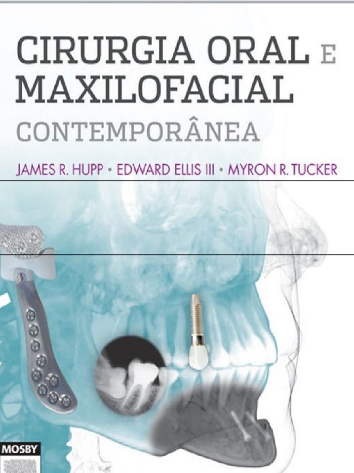 Livro Cirurgia Oral e Maxilofacial Contemporânea Livro Livro Em Pdf Usado 49605014 enjoei