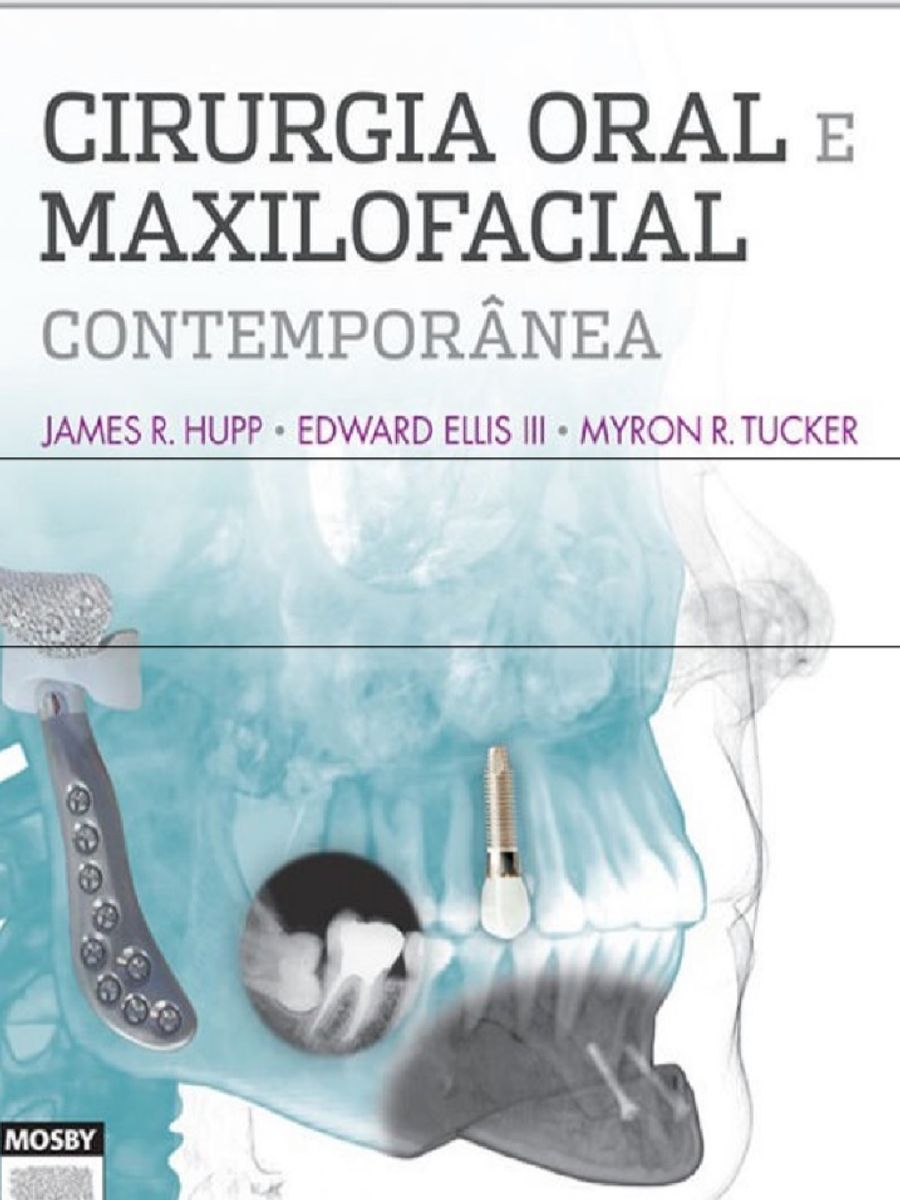 Livro Cirurgia Oral e Maxilofacial Contemporânea Livro Livro Em Pdf Usado 49605014 enjoei