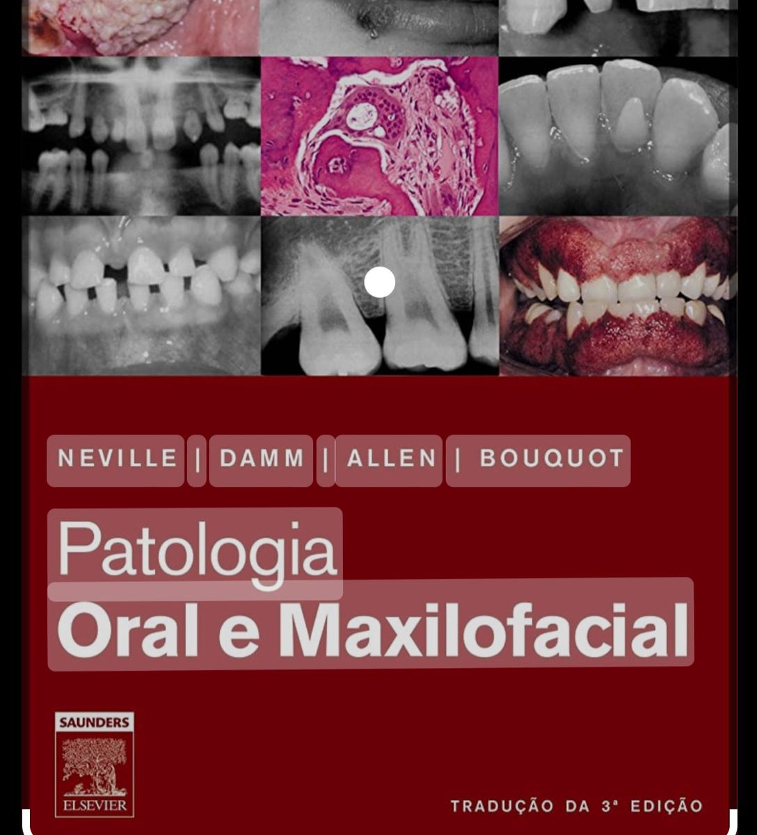 Livro Patologia Oral E Maxilofacial | Livro Elsevier Usado 86412454 ...